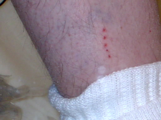 Foto extra 5 do tema 118