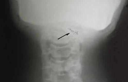 Foto extra 6 do tema 118