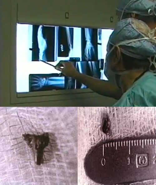 Foto extra 1 do tema 249